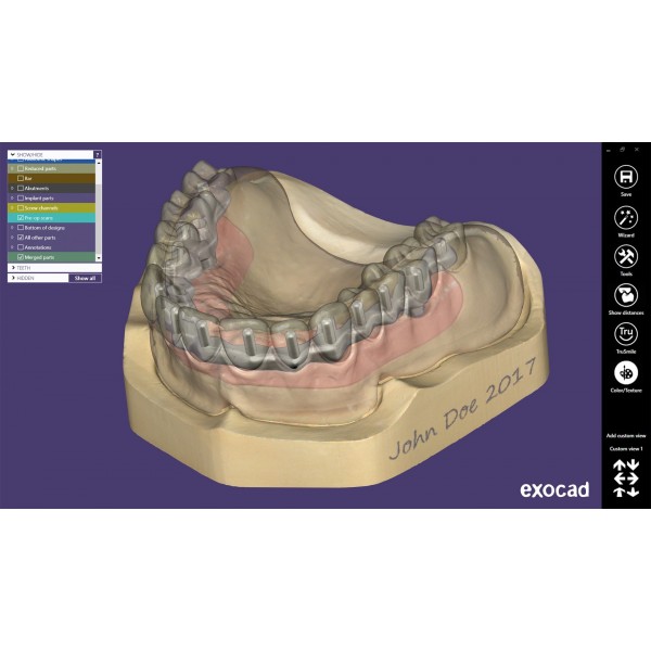 EXOCAD Software Bar Module