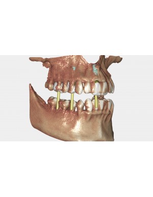 EXOCAD Software DICOM Viewer Module