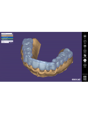 EXOCAD Software Bite Splint Module