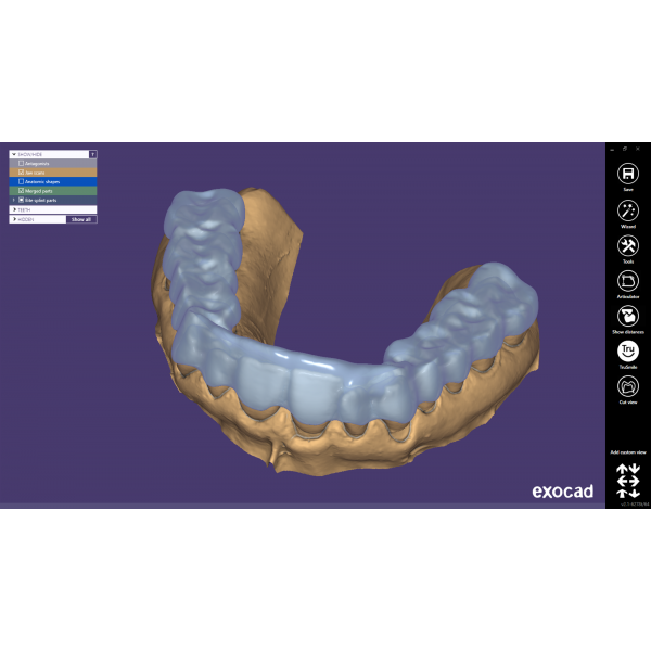 EXOCAD Software Bite Splint Module