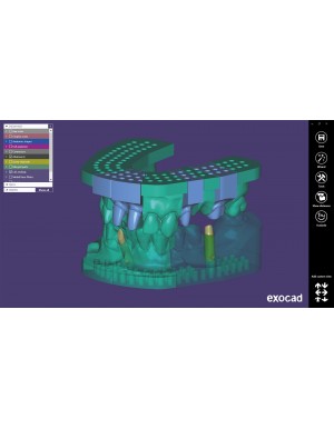 EXOCAD Software Model Creator Module