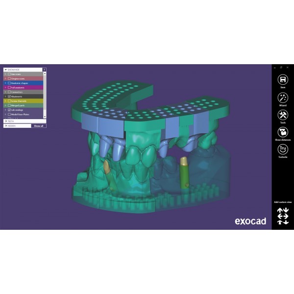 EXOCAD Software Model Creator Module