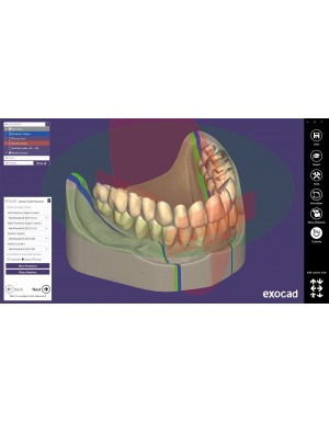 EXOCAD Software Full Denture Module