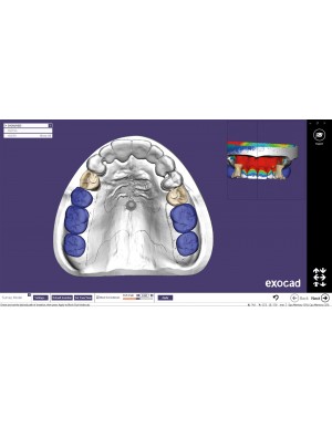 EXOCAD Software PartialCAD Module