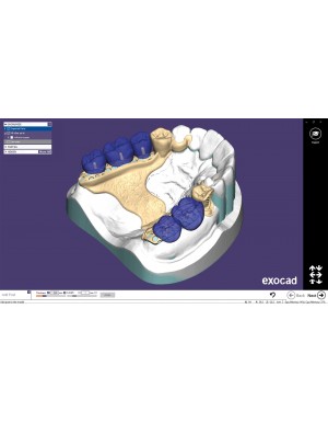 EXOCAD Software PartialCAD Module