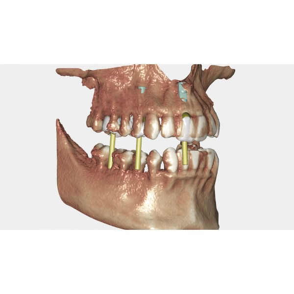 EXOCAD Software DICOM Viewer Module