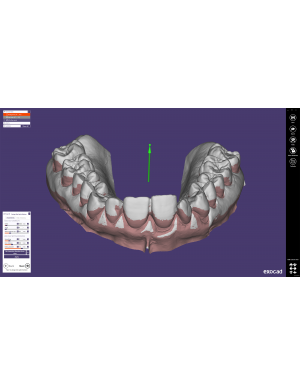 EXOCAD Software Bite Splint Module