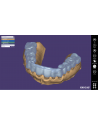 EXOCAD Software Bite Splint Module