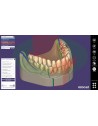 EXOCAD Software Full Denture Module