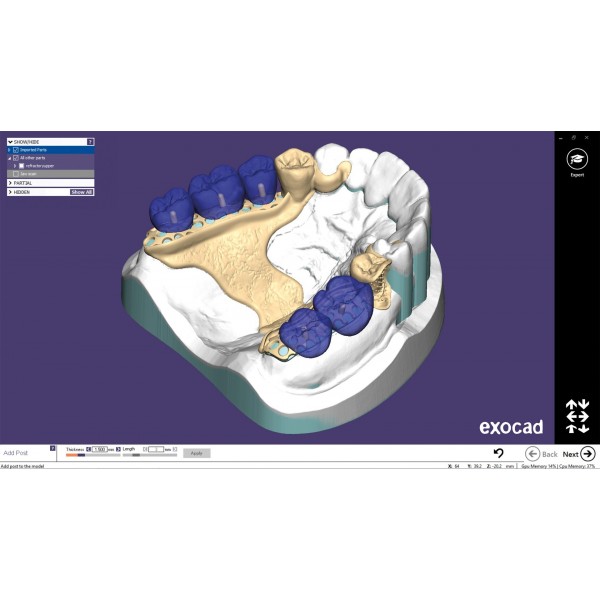 EXOCAD Software PartialCAD Module