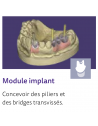 EXOCAD Software Implant Module