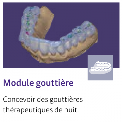 EXOCAD module Gouttière