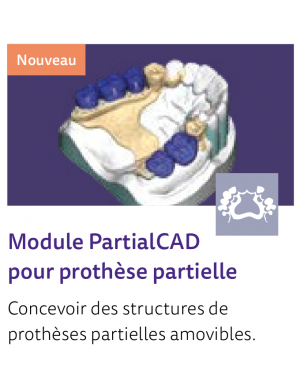 EXOCAD module prothèse partielle