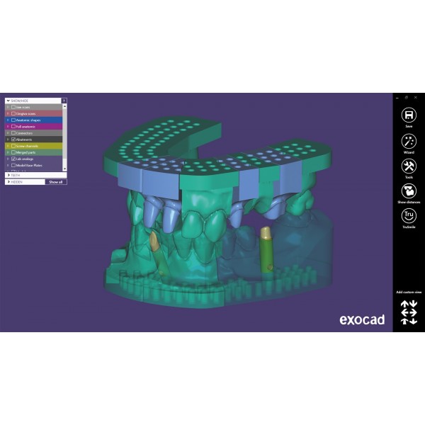 EXOCAD Software Model Creator Module EXOCAD Software Model Creator Module