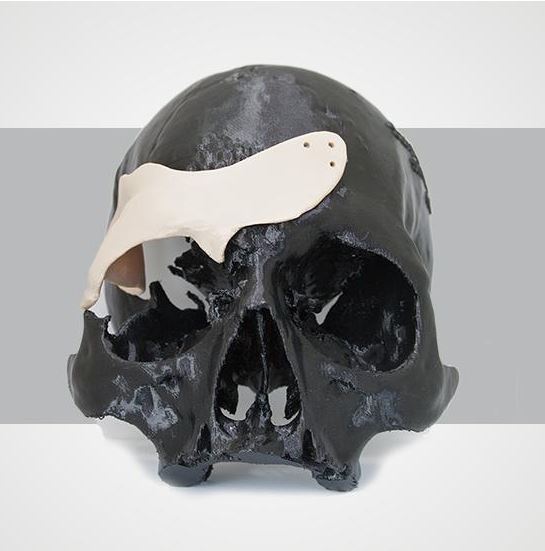 SKULL