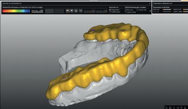 Detax Splint 20. 3