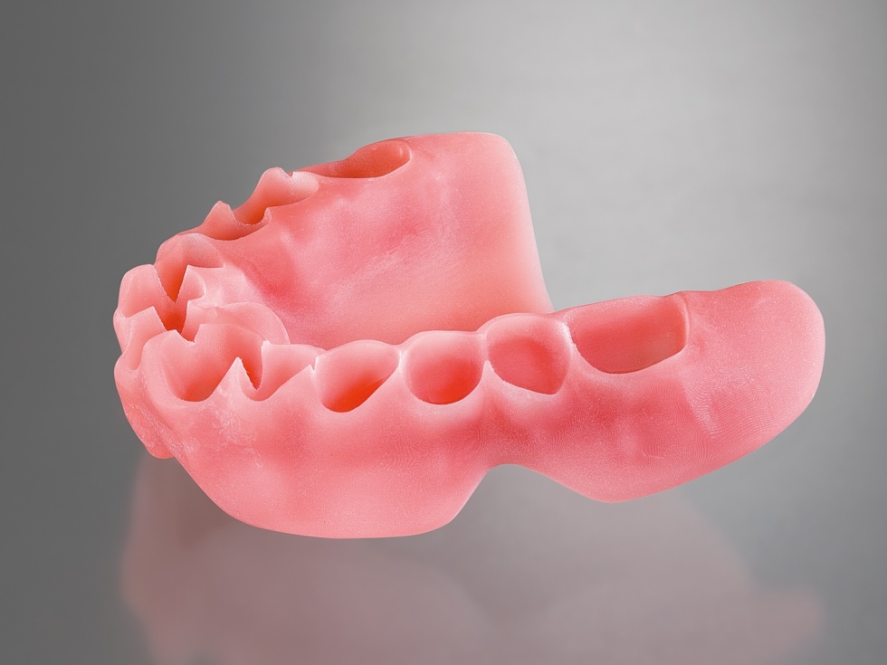 Freeprint denture 1