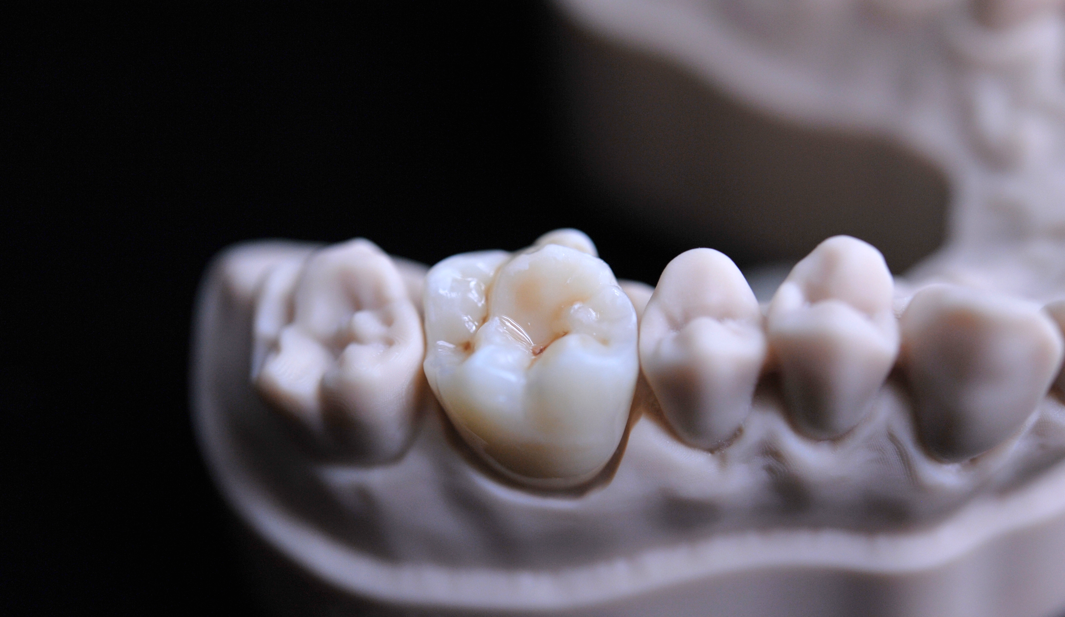 3D printed denture