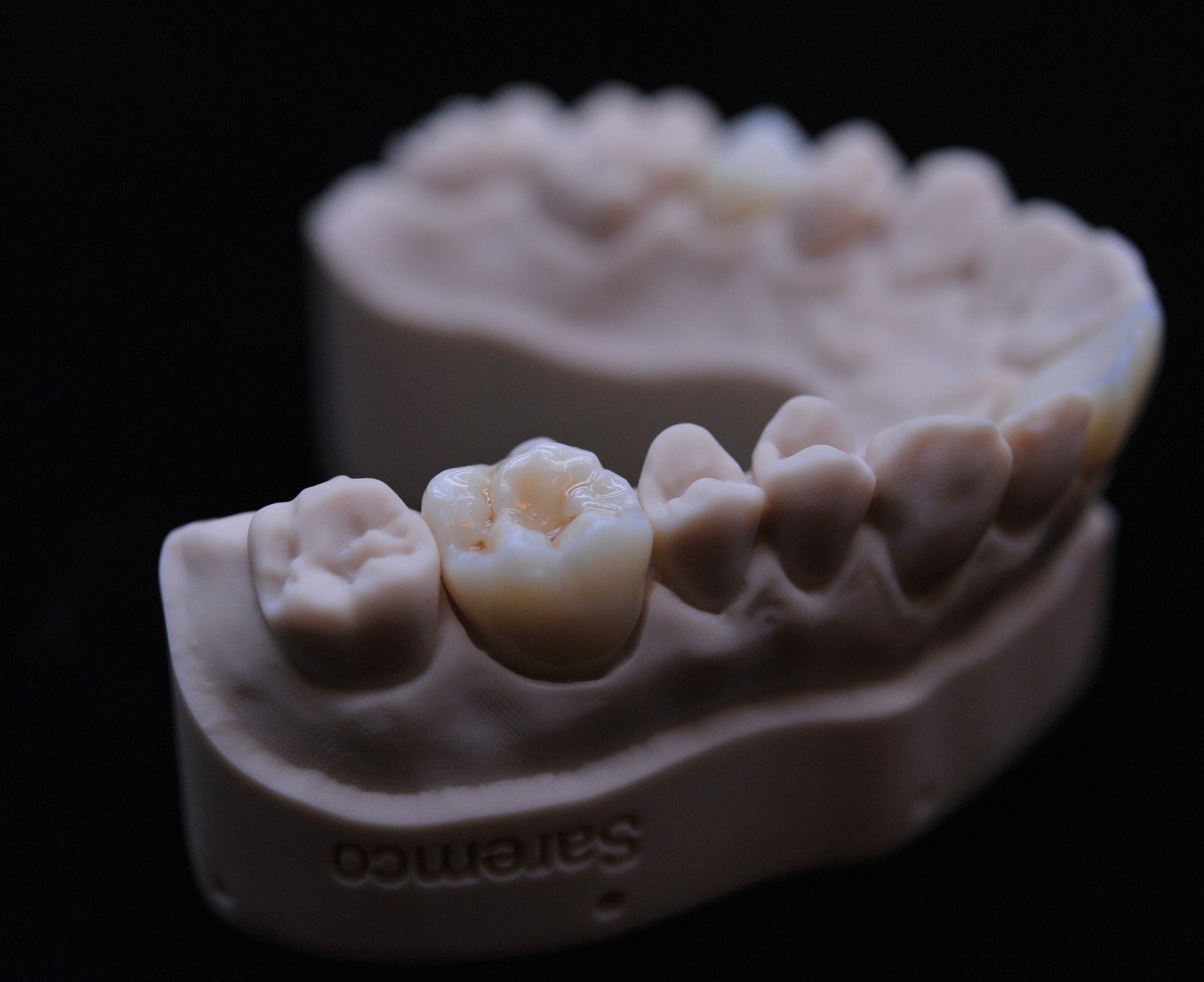Tooth in crowntech resin